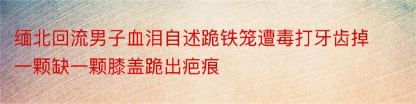 缅北回流男子血泪自述跪铁笼遭毒打牙齿掉一颗缺一颗膝盖跪出疤痕